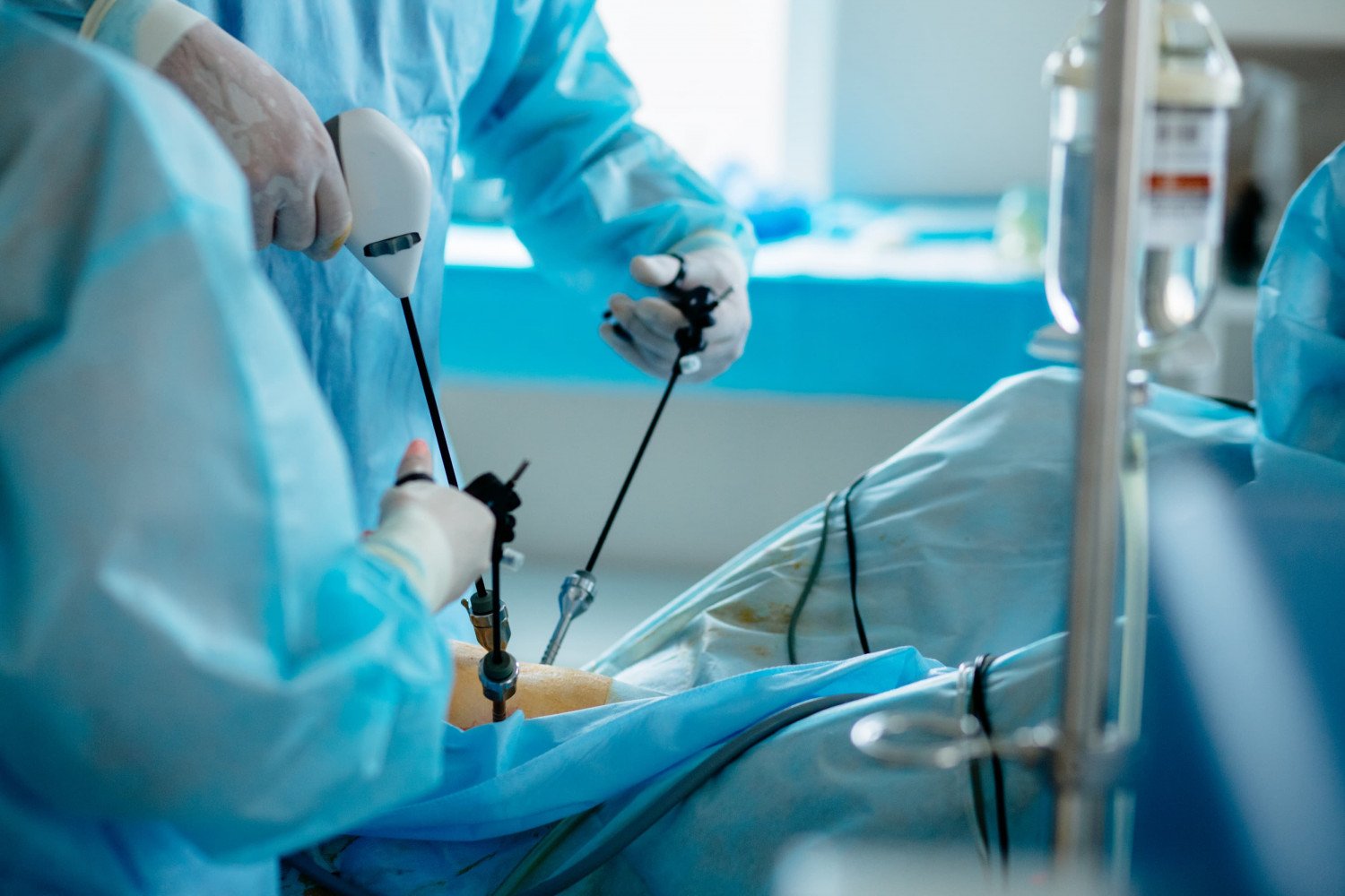 Laparoscopic Instruments